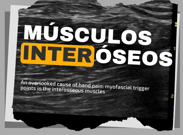 musculos-interoseos-y-ecografia
